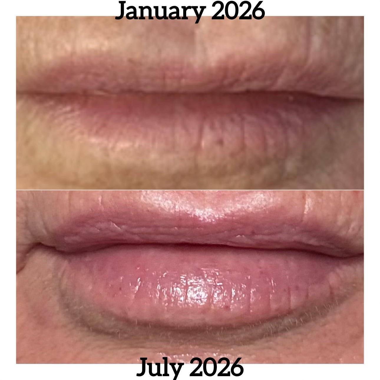 Line Refine Lip Balm